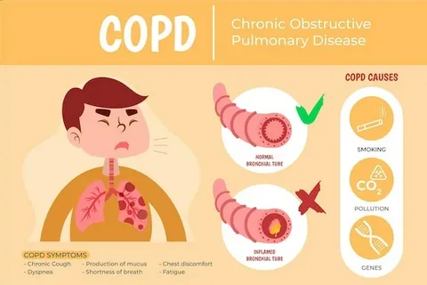 COPD and Lung Disease at Home: What Works, What Doesn’t